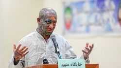امیر تتلو در زندان خودکشی کرد! + عکس