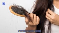 ۳ خوراکی که ریزش مو را تشدید می‌کنند؛ از نوشابه تا الکل