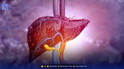 این میوه‌ها کبدتان را چرب می کند مراقب باشید