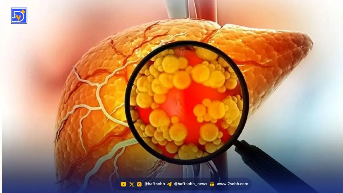 کبدتان چرب است این نوع چای را بنوشید