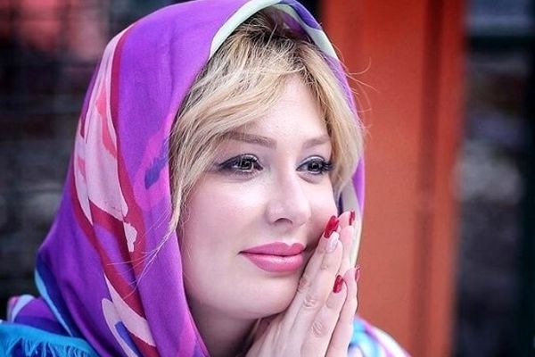 تغییر چهره قابل توجه نیوشا ضیغمی قبل و بعد از عمل زیبایی + بیوگرافی