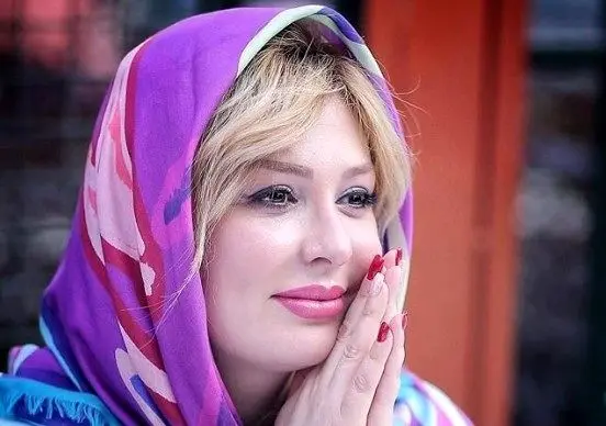 تغییر چهره قابل توجه نیوشا ضیغمی قبل و بعد از عمل زیبایی