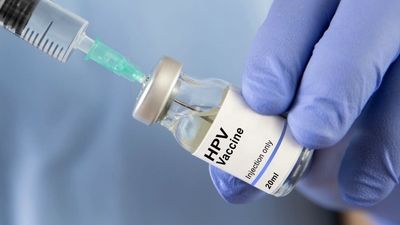 
کاهش بودجه پروژه‌های تحقیقاتیِ واکسن HIV در آمریکا
