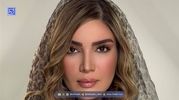 رونمایی از مادرشوهر متین ستوده در کلینیک زیبایی