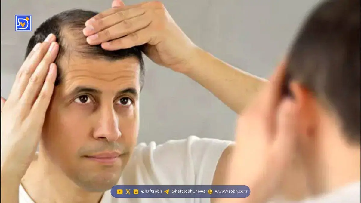 درمان طبیعی ریزش مو؛ اگر موهایتان می‌ریزد این روش بسیار ساده را امتحان کنید