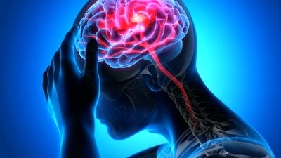 بهترین و موثرترین راه درمان سکته مغزی چیست؟