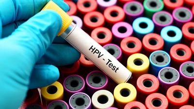  واکسن HPV ایرانی وارد بازار شد 