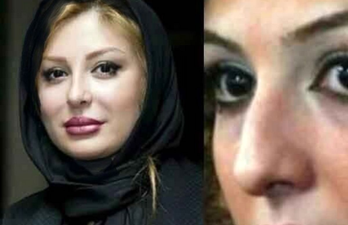 عکس های قبل عمل از زیبایی خانم بازیگران ایرانی/ از شیلا خداداد تا نیوشا ضیغمی +عکس 