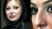 عکس های قبل عمل از زیبایی خانم بازیگران ایرانی/ از شیلا خداداد تا نیوشا ضیغمی +عکس 