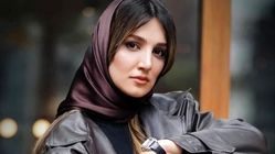 همه عمل‌های زیبایی زارا نادری فر؛ هوژان سریال ناریا چند ساله است (ویدیو)