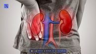 بیماری مزمن کلیه، نهمین علت مرگ در جهان