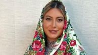 فریبا نادری بازیگر سریال ستایش را قبل از عمل بینی دیده اید؟ + فیلم