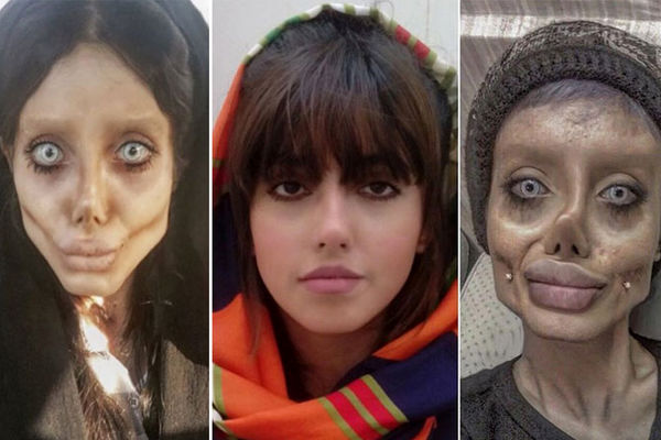 بیوگرافی و زندگی شخصی سحر تبر شاخ اینستاگرام + عکس های قبل از عمل