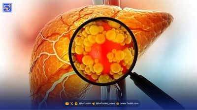 قلب و عروق مرگبارترین بیماری ایرانیان