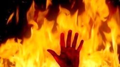 اولین عکس از مامور پلیس راه مشهد; جزئیات شوکه‌کننده از آتش‌سوزی