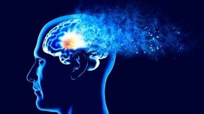 تشخیص ۹ نوع زوال عقل فقط با یک اسکن