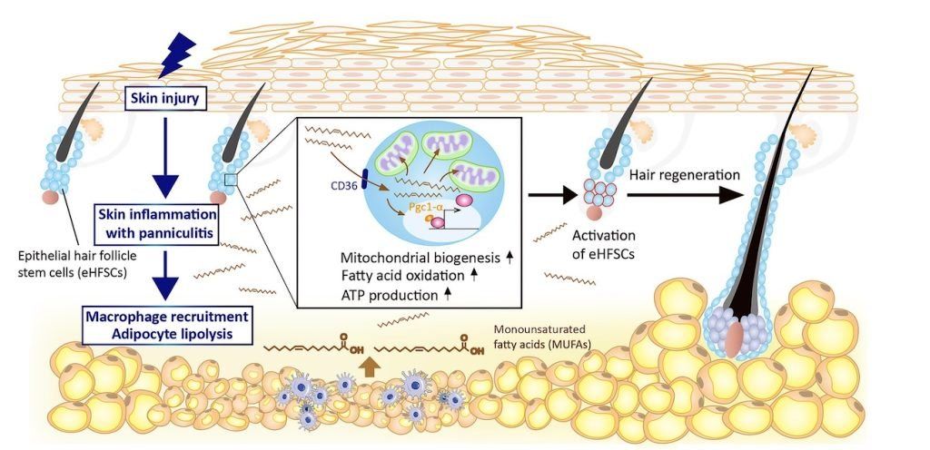 درمان ریزش مو با سرم جدید