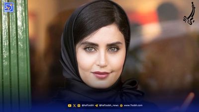 تغییر چهره 100 درصدی بازیگر زلیخا سریال یوسف پیامبر در 64 سالگی با عمل و تزریق زیاد!