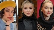 تغییر چهره عجیب نازنین بیاتی بعد از عمل جراحی؛ چی بوده، چی شده! + عکس
