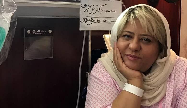 اسکویی