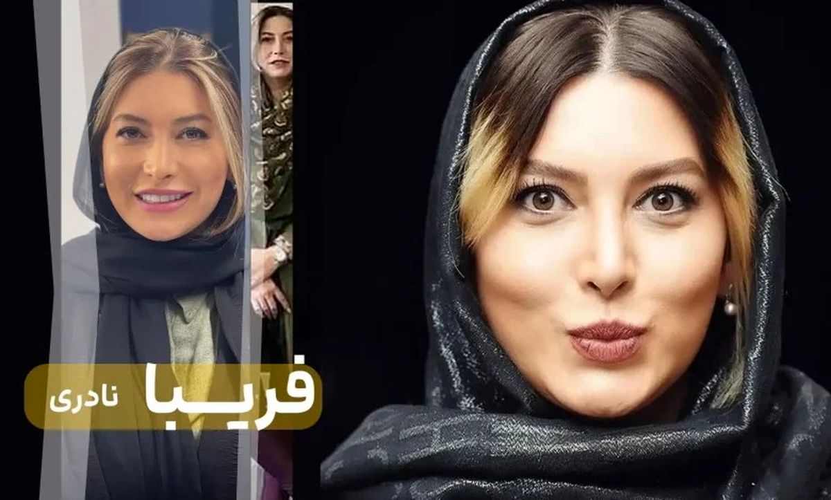 فریبا نادری قبل و بعد از عمل زیبایی؛ چی بود و چی شد؟!