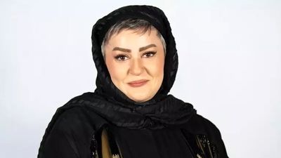 تغییر چهره ‌فاحش صبا کمالی بازیگر  سریال پس از باران ‌در میانسالی