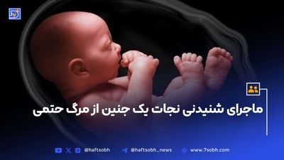 جزئیات سامانه سقط جنین