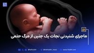 ماجرای شنیدنی نجات یک جنین از مرگ حتمی