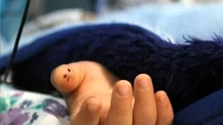 مرگ ۴۸ کودک به دلیل نبود مترجم