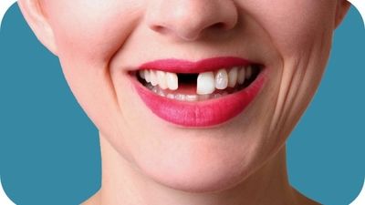 با این ویتامین‌ها دندان‌هایی سفید داشته باشید