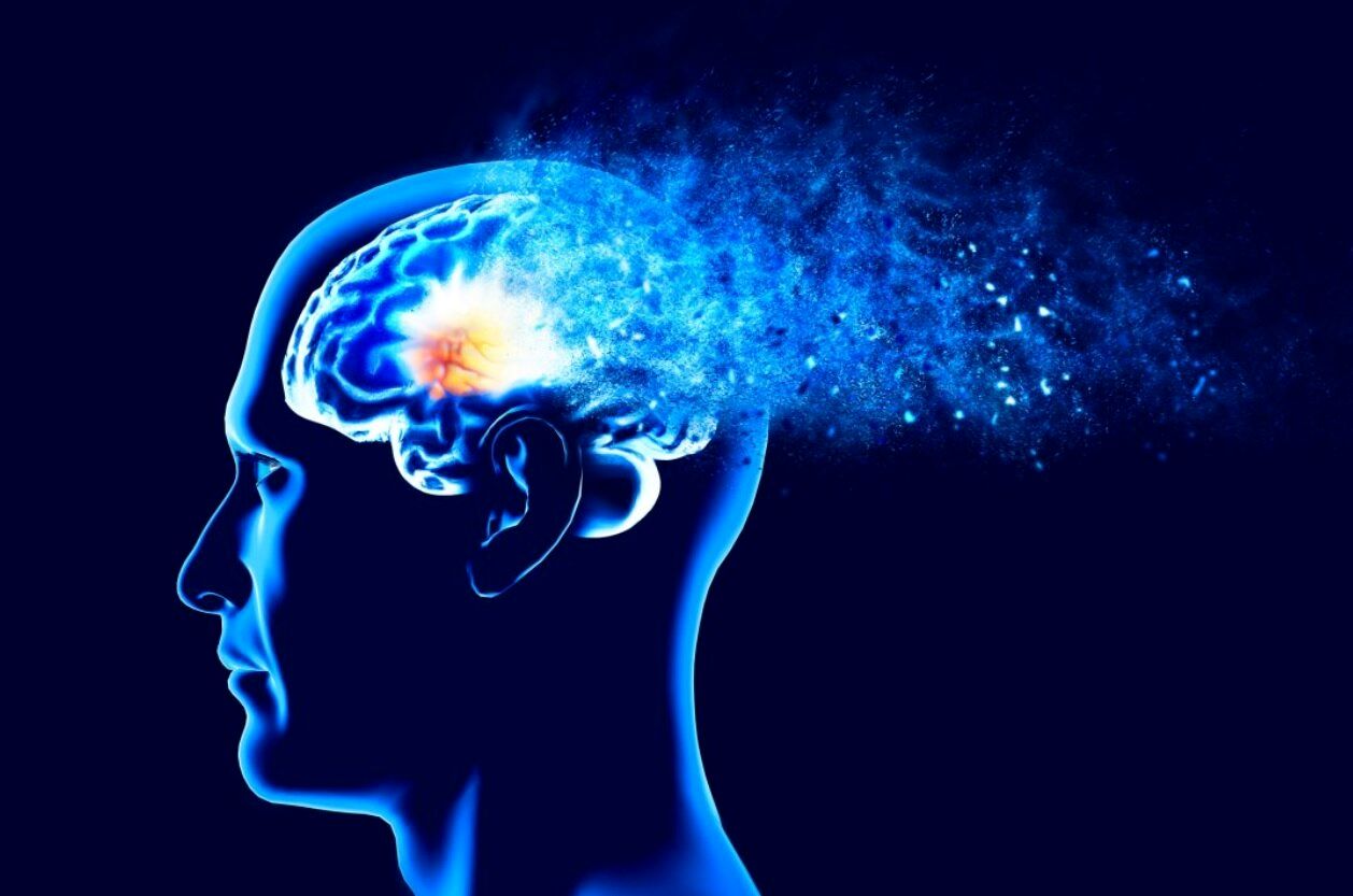 تشخیص ۹ نوع زوال عقل فقط با یک اسکن