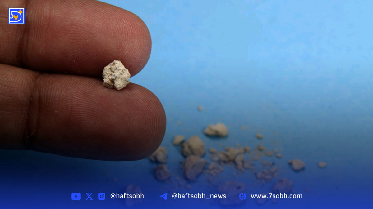 با این موارد سنگ کلیهتان را از بین ببرید