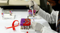 خداحافظی با ایدز؛ موفقیت واکسن آزمایشی «اچ‌آی‌وی» در بدن