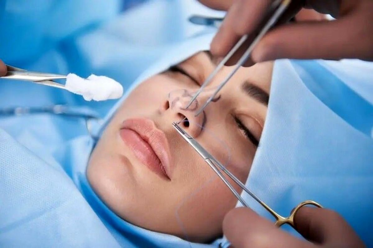 هشدار تخفیفهای آخر سالی با تکنیسینهای بیتجربه برای نابودی زیبایی شما!