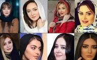 نگاهی به تغییرات شگفت‌انگیز بازیگران زن ایرانی؛ از چهره‌های قبل از عمل تا زیبایی‌های جدید + عکس